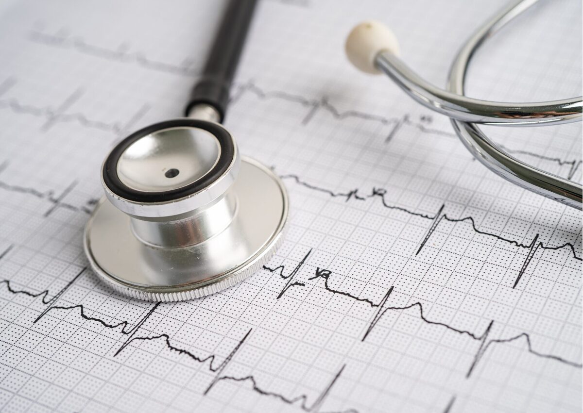 ekg.jpg